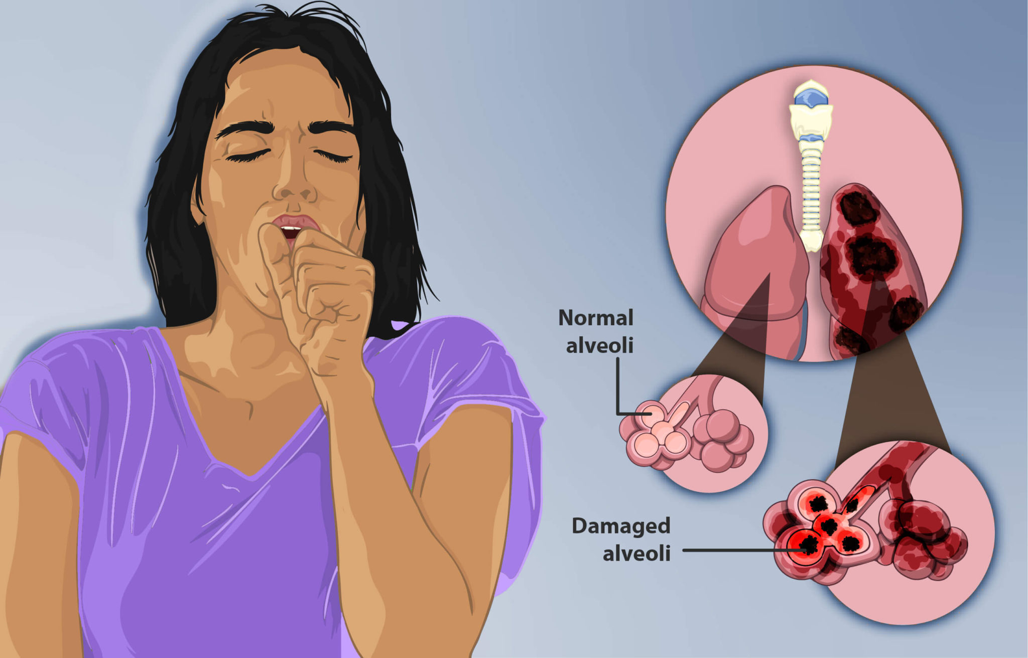COPD Diagnosis & Treatment Ahmedabad