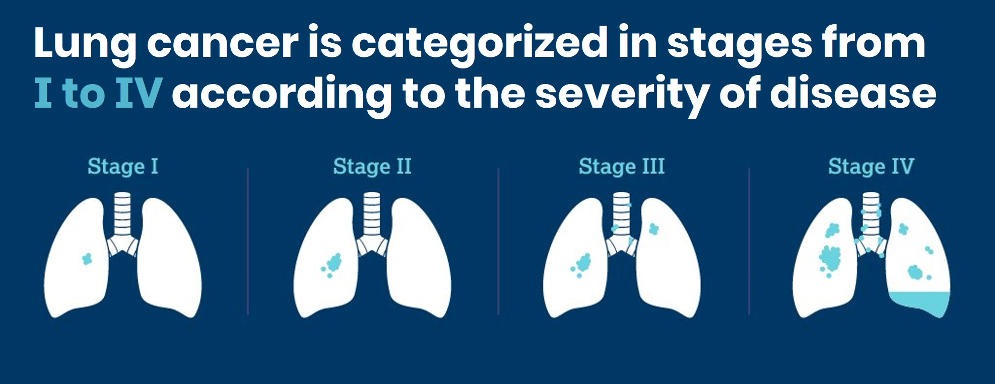 stages-of-lung-cancer-1-4-chart