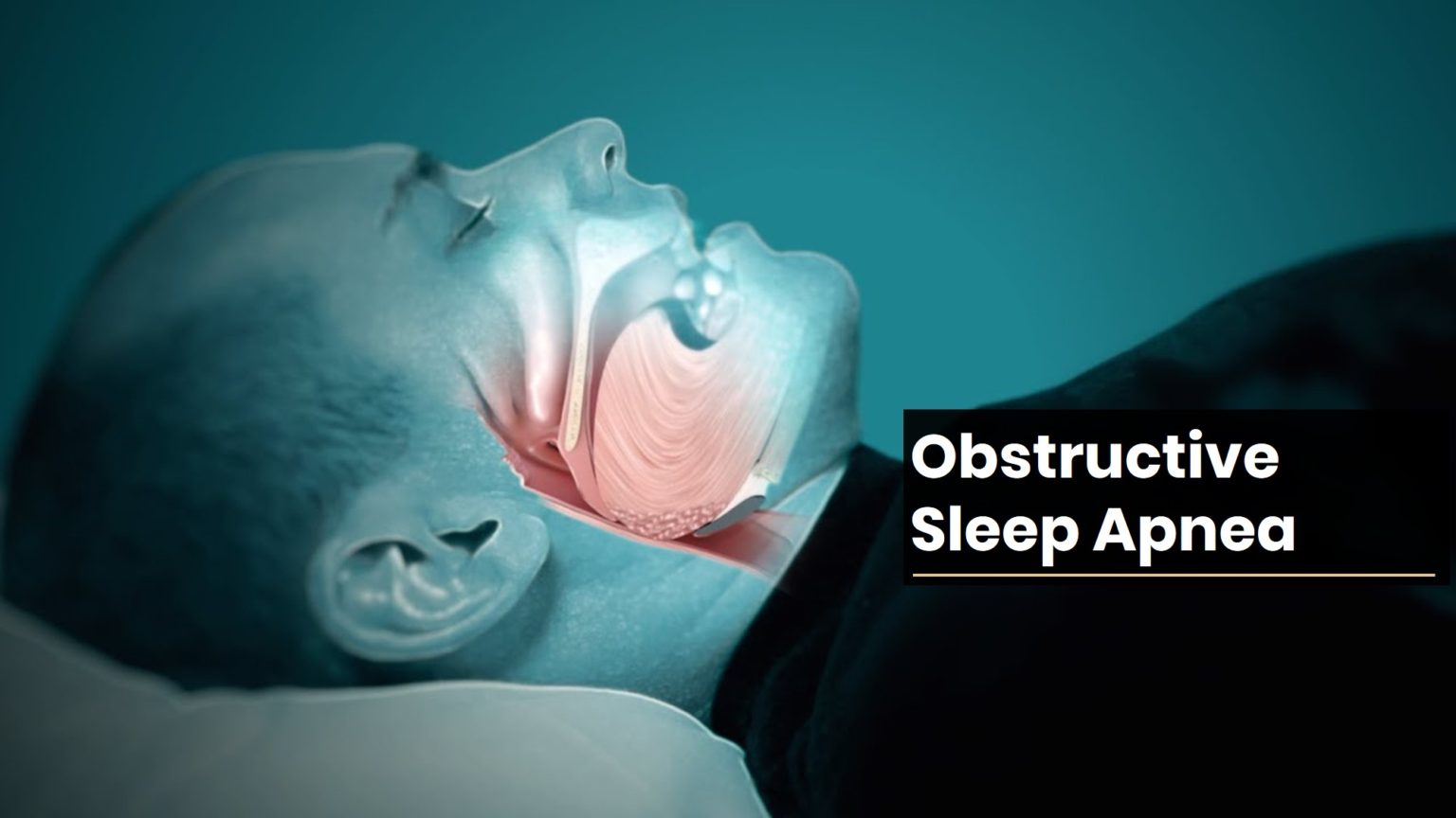 Obstructive Sleep Apnea Treatment | Polysomnography | CPAP | Ahmedabad